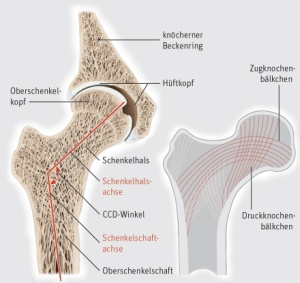 hueftgelenk_01_klein.jpg, 47kB